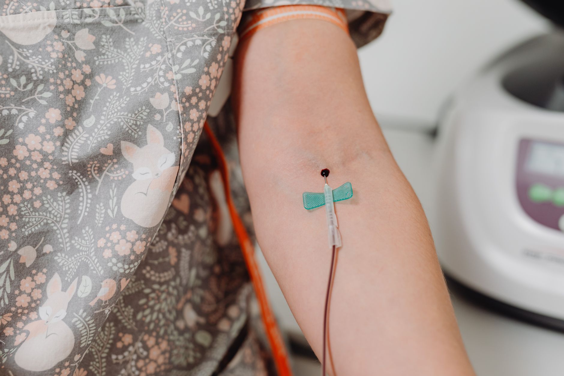 Close-up shot of an intravenous catheter inserted in a patient's arm for medical treatment.